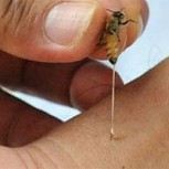 ¿Dónde duele más la picadura de una abeja? Sacrificado estudio de especialista