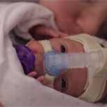 Emocionante video del año de vida de un bebé prematuro