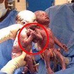 Dos bebés conmueven al mundo tras nacer tomadas de la mano