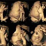Ecografía muestra cómo reacciona un feto cuando su madre fuma