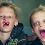 El extraño caso de los “niños vampiros de Inglaterra”