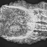 Esqueleto con una misteriosa mano de hierro: Restos tienen 600 años de antigüedad