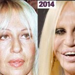 Así se deterioró con las cirugías el rostro de Donatella Versace en 22 años