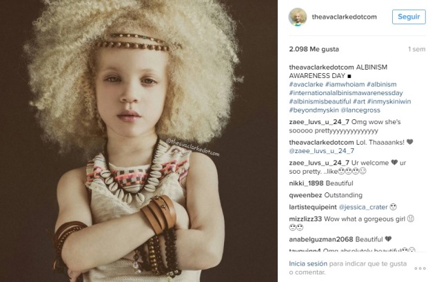Modelo de 8 años es furor en Instagram: ¿La razón? Es albina de raza negra  - Guioteca