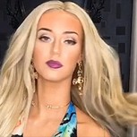 Modelo con una rara enfermedad revela su verdadero aspecto y causa impacto por sus fotos