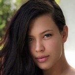 Michelle Carvalho sorprende por su nuevo look “obligada” por un problema de salud
