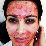Sangre licuada, el nuevo secreto de belleza de las mujeres