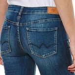 Brazilian Butt Lift: La cirugía estética que está de moda entre las mujeres