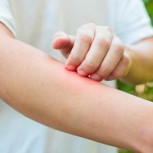 Cuando la primavera irrita la piel: Síntomas y cuidados para las alergias cutáneas