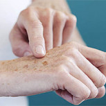 Cuidado con las manos: Cómo prevenir los daños que causa el sol en verano 