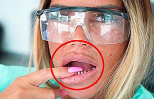 Videos: Afilarse los dientes, la peligrosa tendencia de TikTok que preocupa a los dentistas