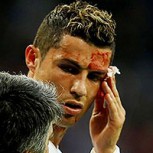 La cara de horror de la madre y la novia de Cristiano Ronaldo al ver su rostro ensangrentado