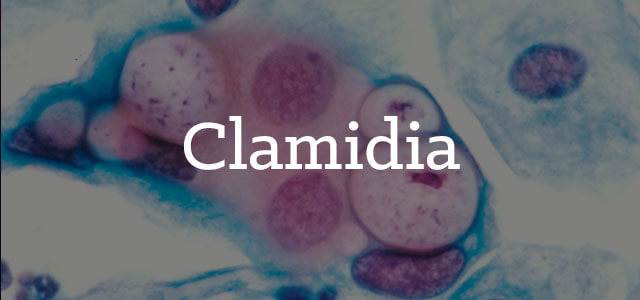Clamidia