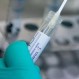 Positividad de exámenes PCR a nivel país fue del 4,3%: Casos activos de Covid-19 bajaron a 20.647