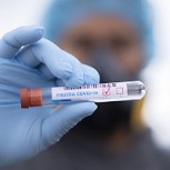 Minsal reporta considerable alza de casos covid: 18.446 positivos, la cifra más alta de la pandemia