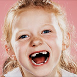 ¿Qué significa soñar con que se nos caen los dientes?