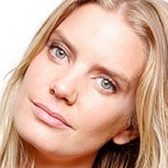 ¿Qué le pasó en el rostro a Javiera Acevedo? ¡Sorprendente cambio!