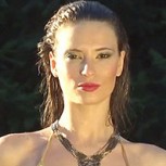 Ex chica reality Julia Fernándes se somete a cirugía plástica: dice que no usará más relleno