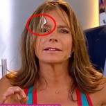 Ivette Vergara hiere a Kathy Salosny en vivo: la animadora quedó sangrando