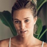 ¿Qué le pasó a Kika Silva en la cara? La modelo generó ola de comentarios por su imagen