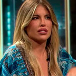 Coté López confesó que se arrepiente de las intervenciones estéticas que se realizó en su rostro: “No tenía necesidad”
