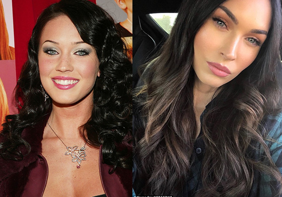 megan fox antes y despues de los implantes mamarios