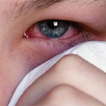 Alergias oculares podrían aumentar en el 2018 a causa del calentamiento global