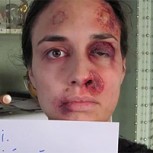 Viral de Joven maltratada, una foto al día por un año, causa impacto en Europa